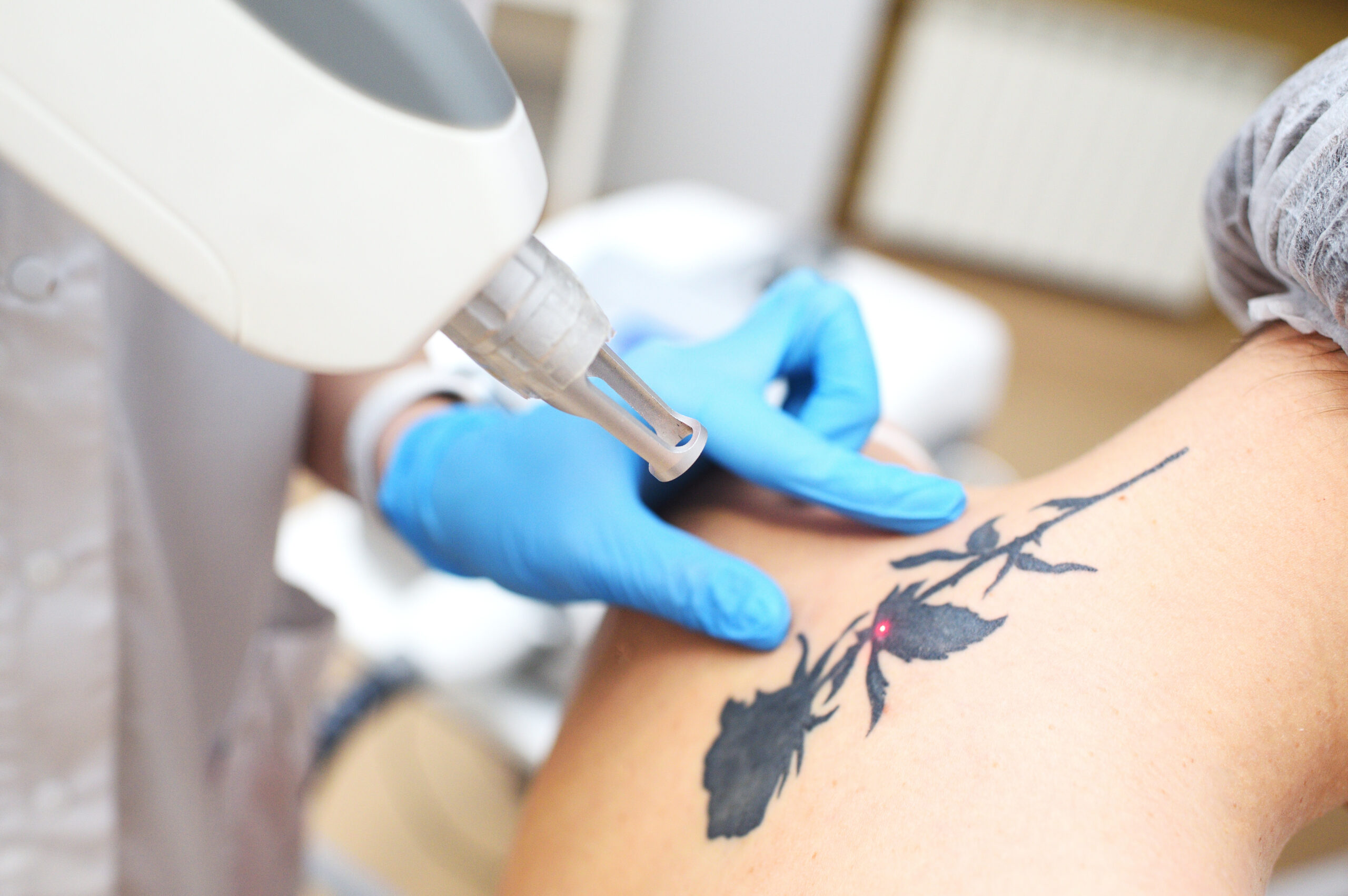Qualifi Level 5 certificate in Tattoo Fade and Removal